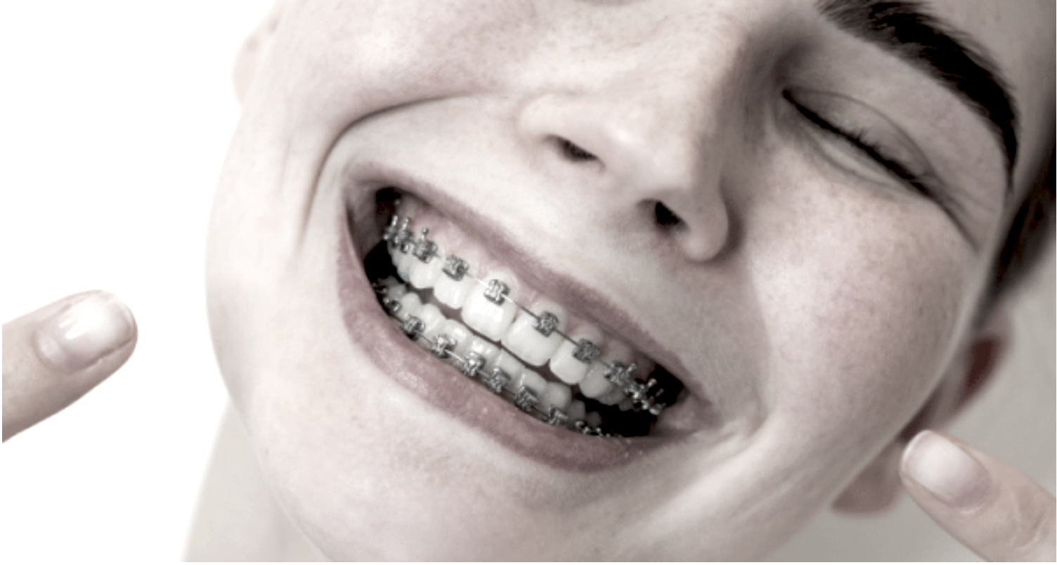 smile-makeover-proffesional 