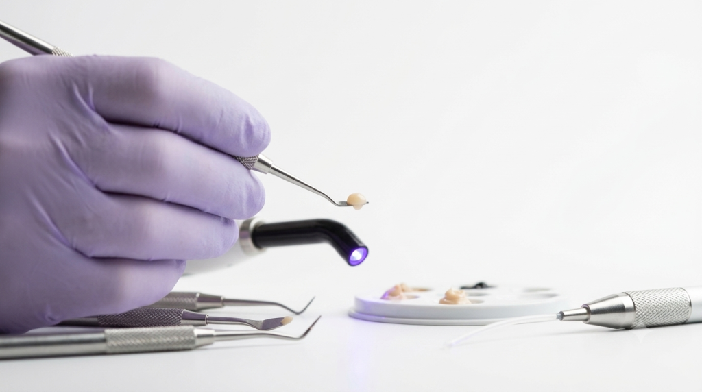 Composite bonding-science-alma